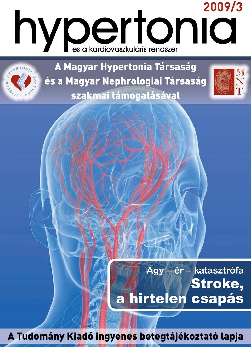 támogatásával Agy ér katasztrófa Stroke, a