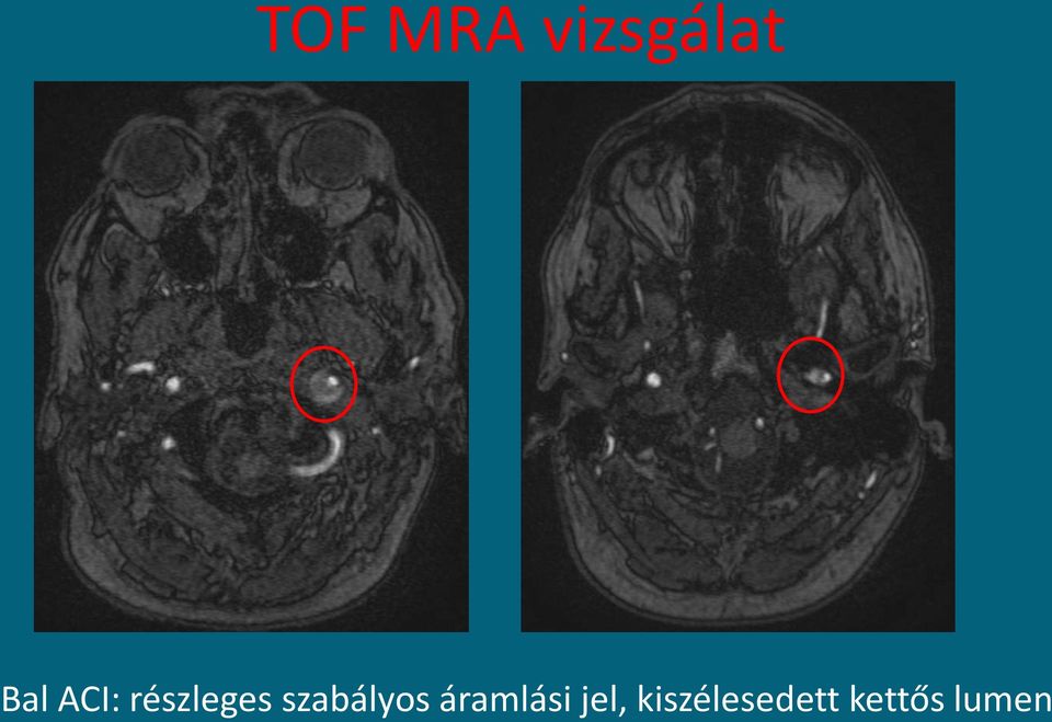 szabályos áramlási