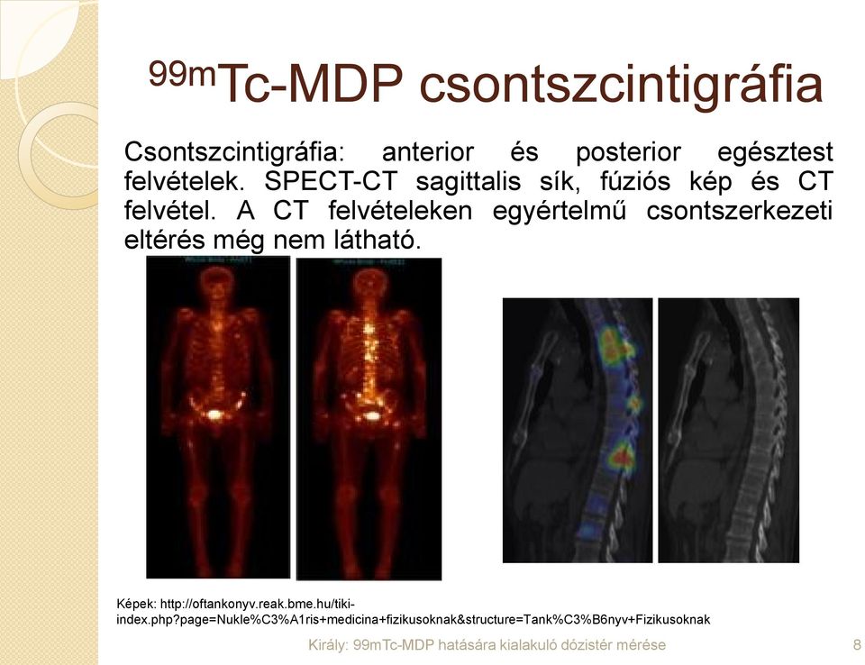 A CT felvételeken egyértelmű csontszerkezeti eltérés még nem látható.