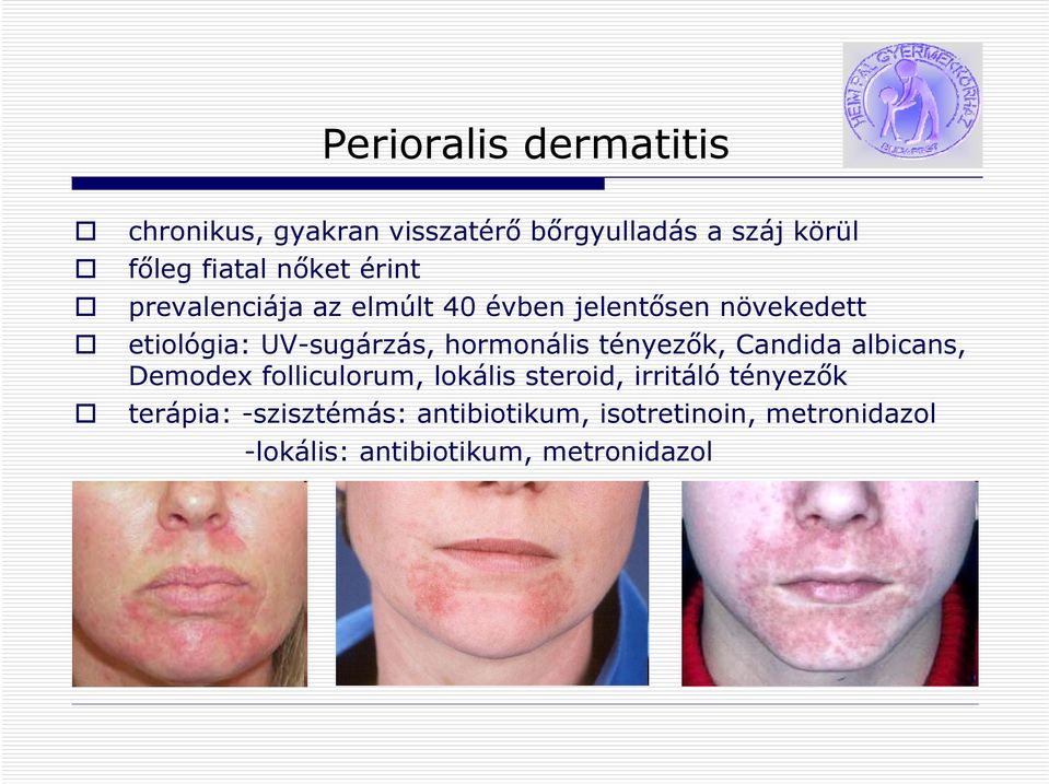 hormonális tényezők, Candida albicans, Demodex folliculorum, lokális steroid, irritáló