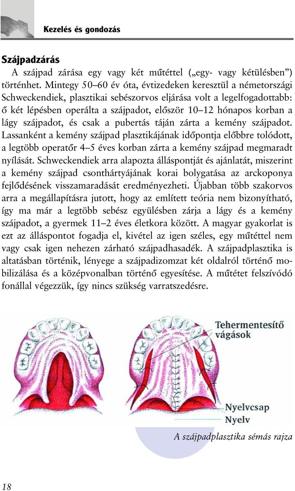 lágy szájpadot, és csak a pubertás táján zárta a kemény szájpadot.