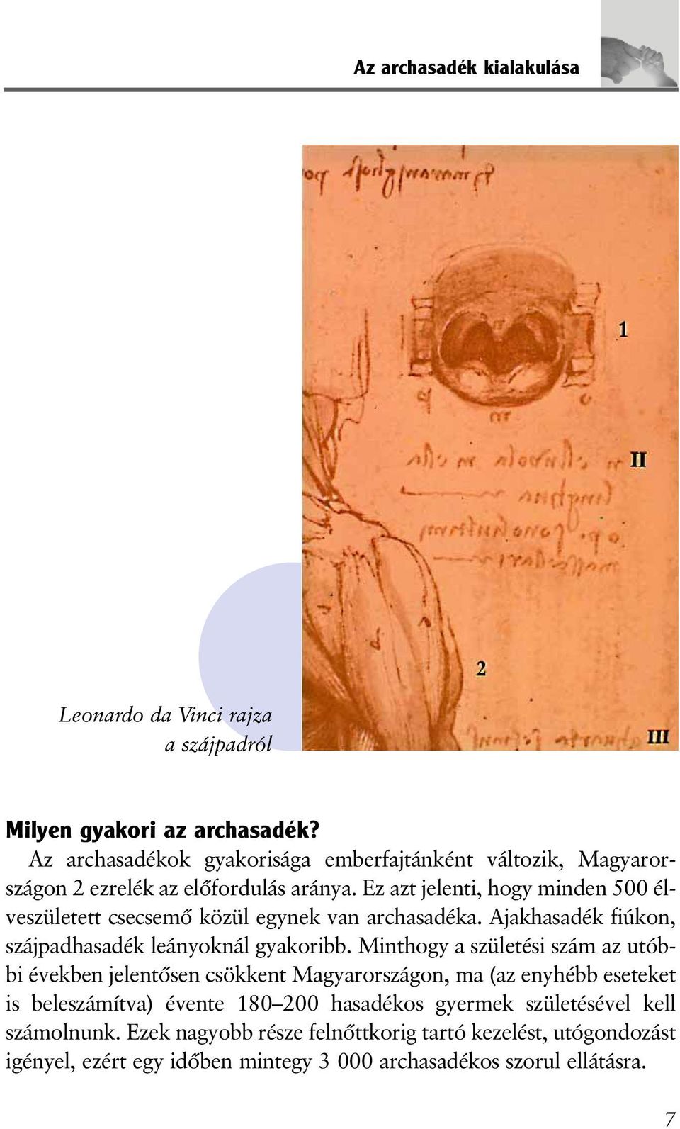 Ez azt jelenti, hogy minden 500 élveszületett csecsemõ közül egynek van archasadéka. Ajakhasadék fiúkon, szájpadhasadék leányoknál gyakoribb.