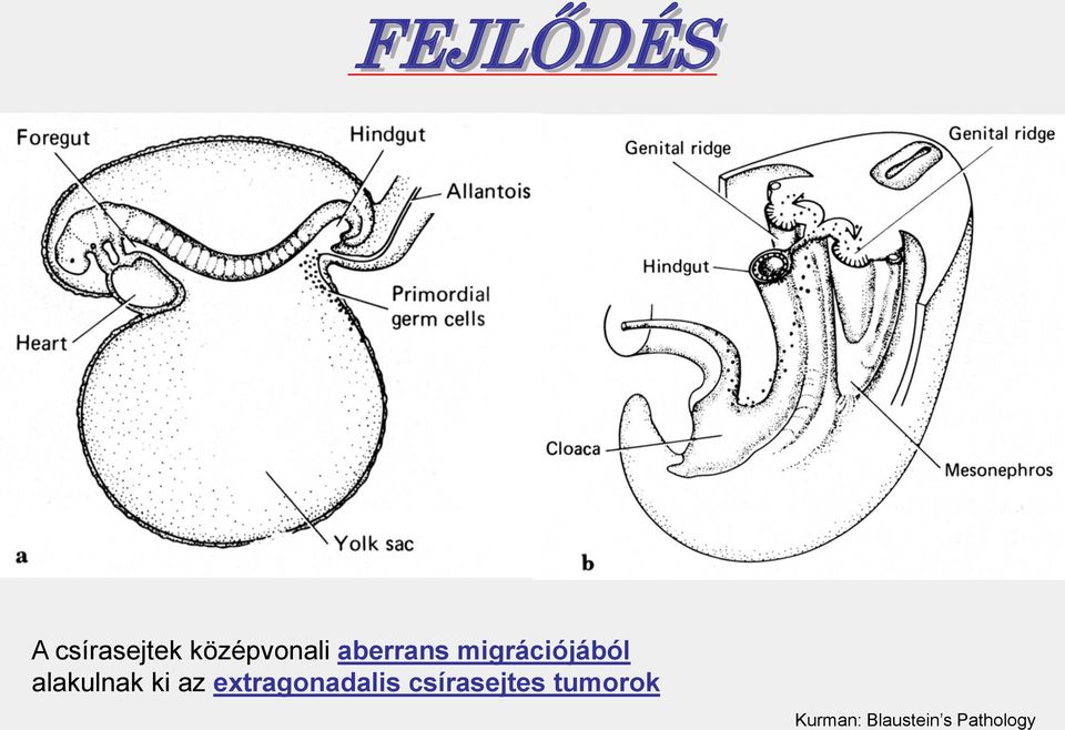 ki az extragonadalis csírasejtes