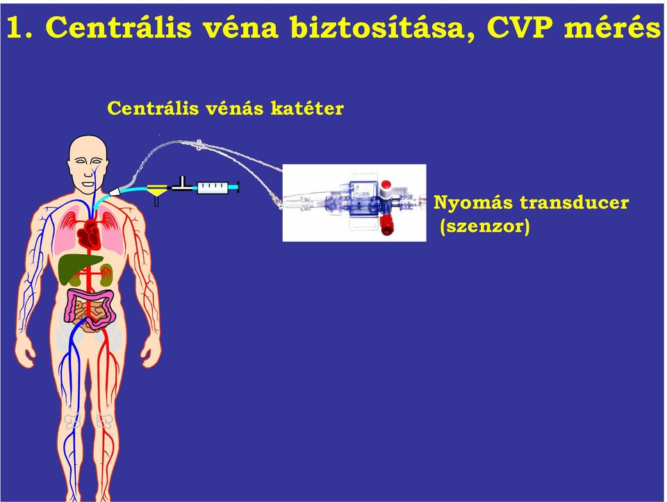 Centrális vénás