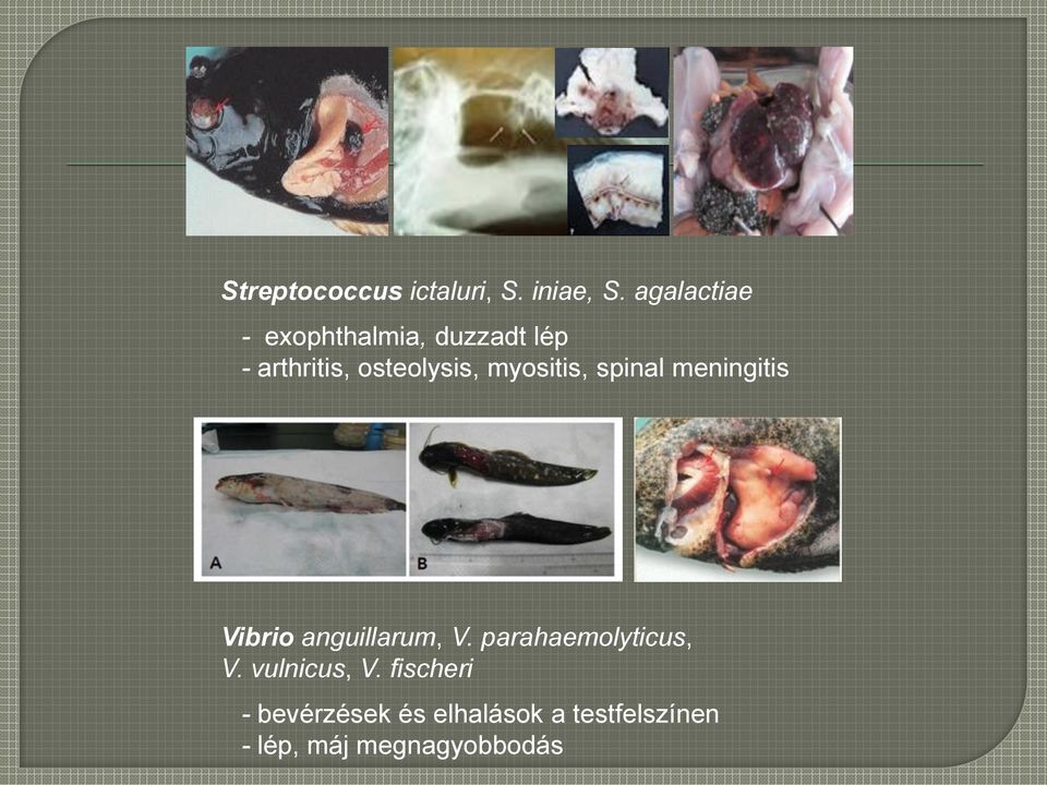 myositis, spinal meningitis Vibrio anguillarum, V.