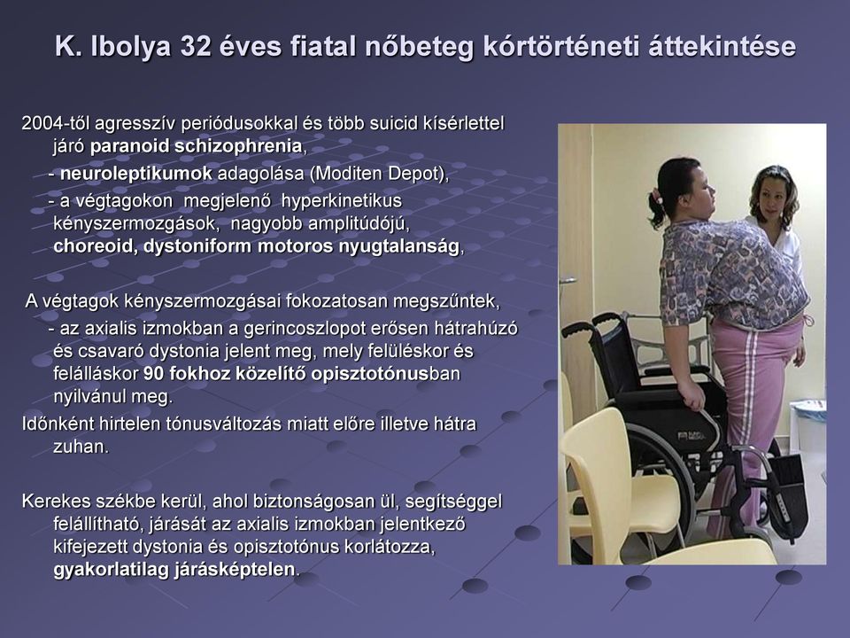 gerincoszlopot erősen hátrahúzó és csavaró dystonia jelent meg, mely felüléskor és felálláskor 90 fokhoz közelítő opisztotónusban nyilvánul meg.