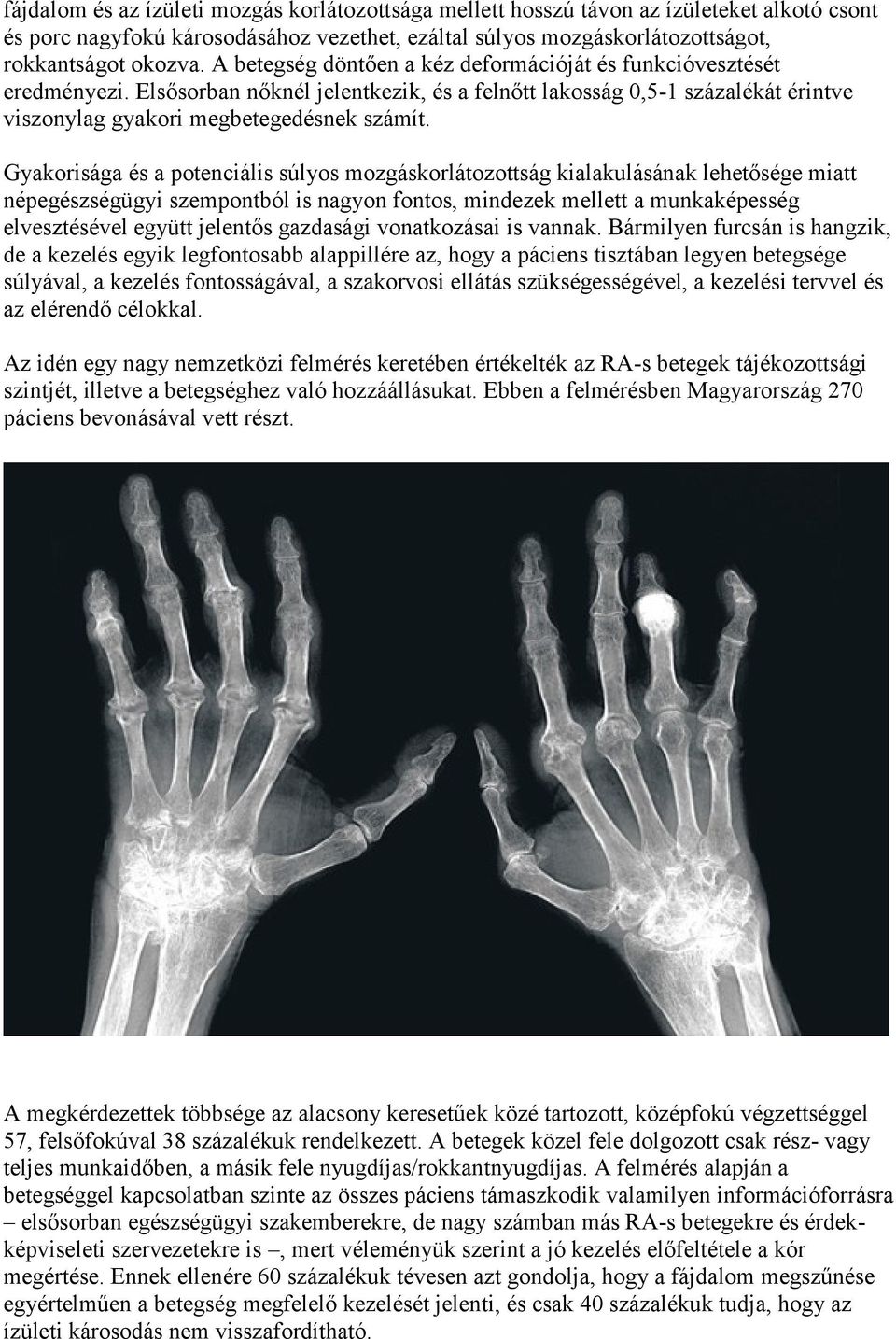 Gyakorisága és a potenciális súlyos mozgáskorlátozottság kialakulásának lehetősége miatt népegészségügyi szempontból is nagyon fontos, mindezek mellett a munkaképesség elvesztésével együtt jelentős