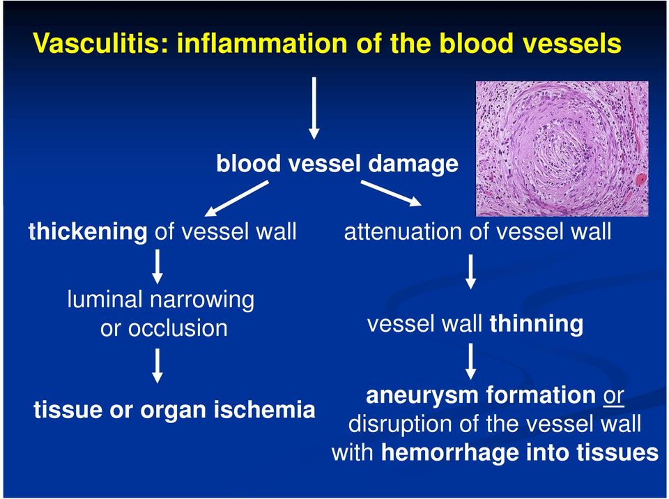 narrowing or occlusion vessel wall thinning tissue or organ ischemia