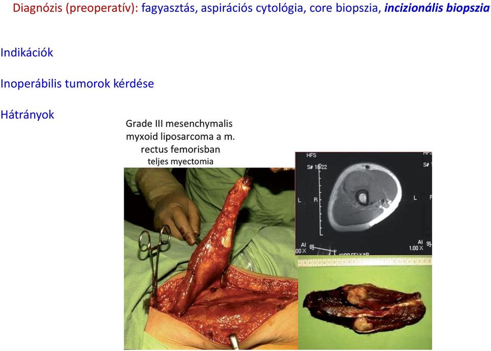 incizionális biopszia Indikációk