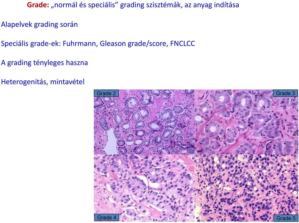 Fuhrmann, Gleason grade/score, FNCLCC A grading tényleges