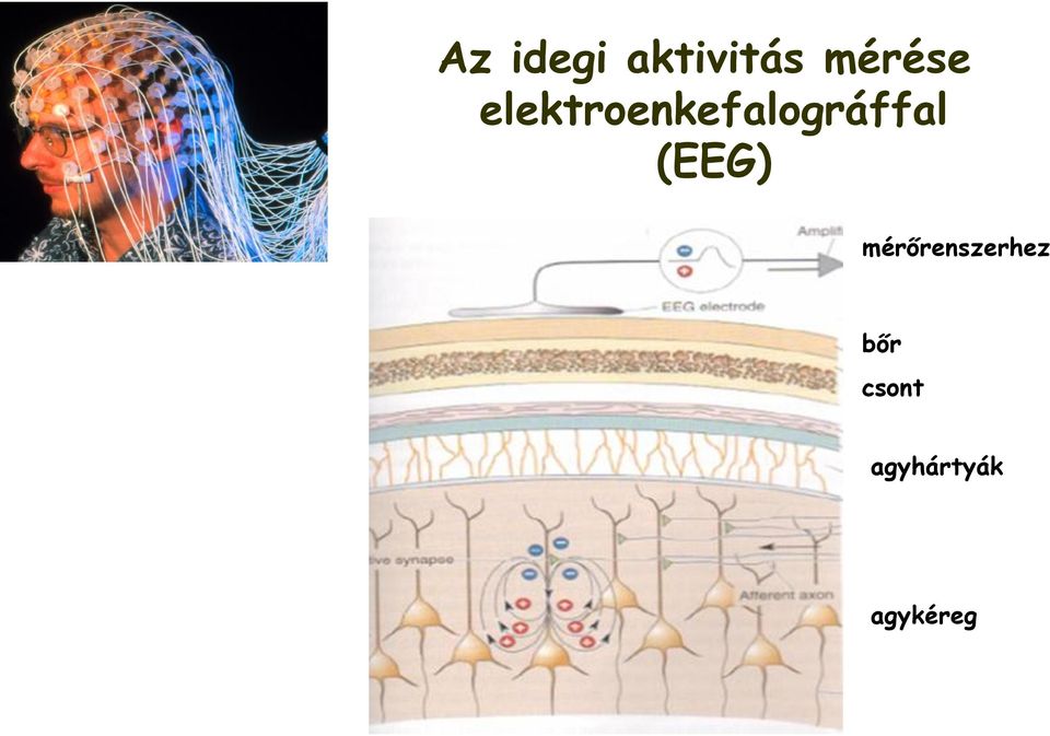 elektroenkefalográffal