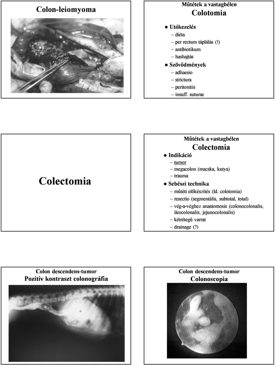 suturae Colectomia Mûtétek a vastagbélen Colectomia Indikáció tumor megacolon (macska, kutya) trauma Sebészi technika műtéti előkészítés (ld.