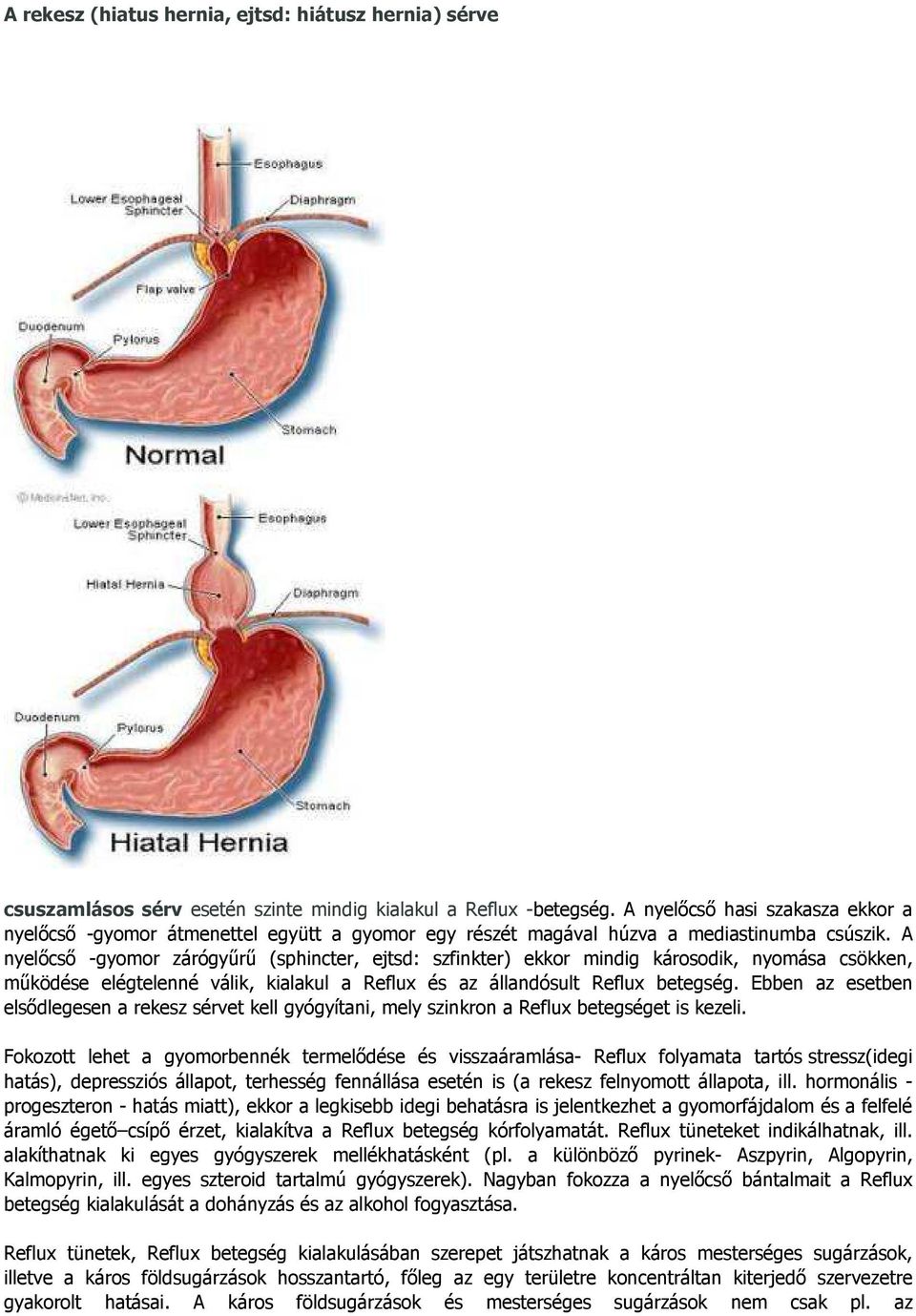 A nyelőcső -gyomor zárógyűrű (sphincter, ejtsd: szfinkter) ekkor mindig károsodik, nyomása csökken, működése elégtelenné válik, kialakul a Reflux és az állandósult Reflux betegség.