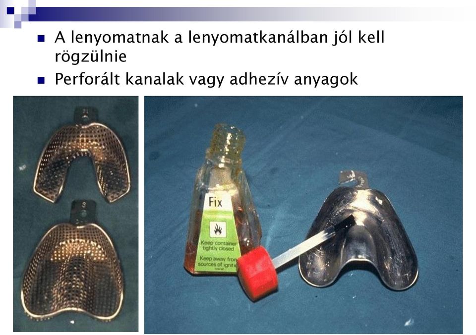 kell rögzülnie