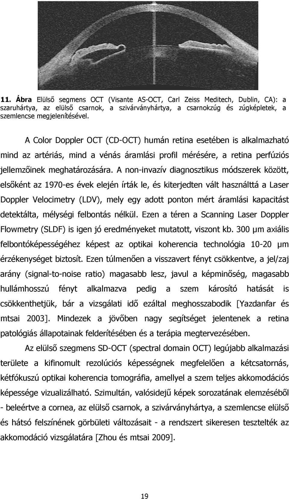 A non-invazív diagnosztikus módszerek között, elsőként az 1970-es évek elején írták le, és kiterjedten vált használttá a Laser Doppler Velocimetry (LDV), mely egy adott ponton mért áramlási