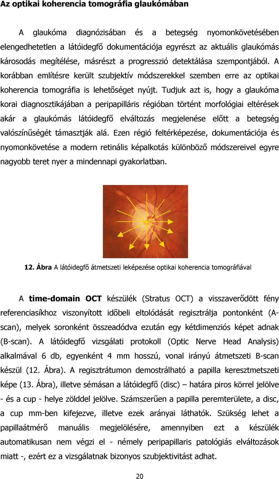 Tudjuk azt is, hogy a glaukóma korai diagnosztikájában a peripapilláris régióban történt morfológiai eltérések akár a glaukómás látóidegfő elváltozás megjelenése előtt a betegség valószínűségét