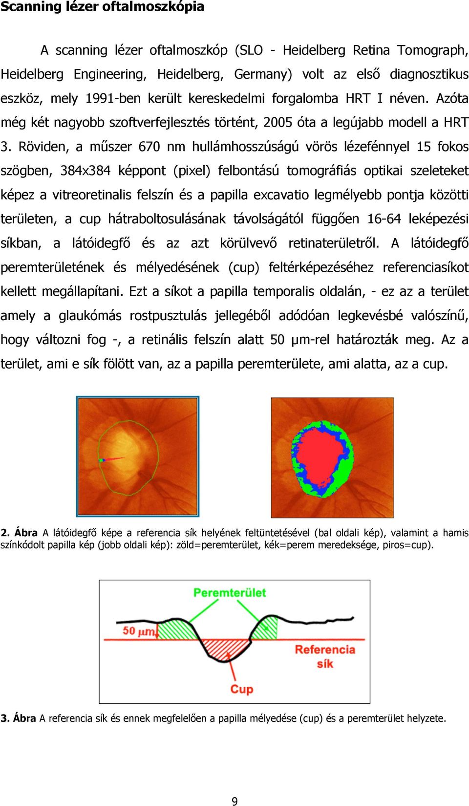 Röviden, a műszer 670 nm hullámhosszúságú vörös lézefénnyel 15 fokos szögben, 384x384 képpont (pixel) felbontású tomográfiás optikai szeleteket képez a vitreoretinalis felszín és a papilla excavatio