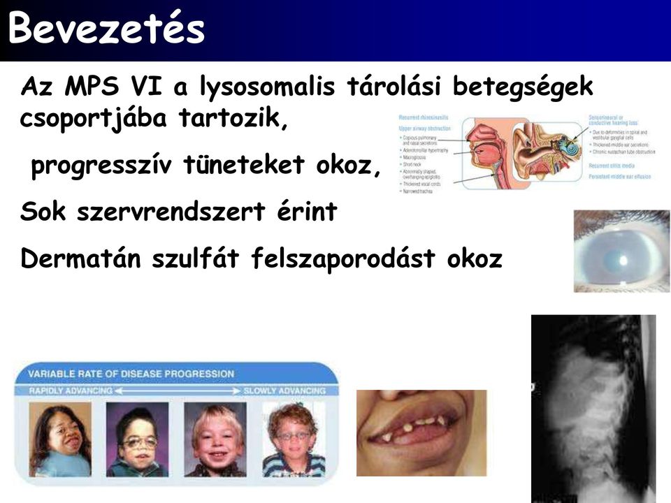 progresszív tüneteket okoz, Sok