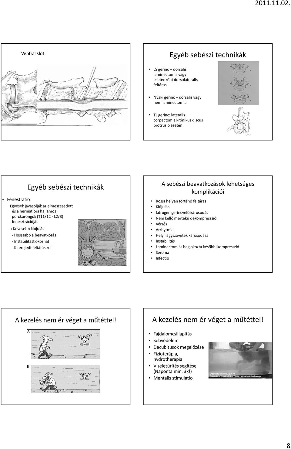 discus protrusio esetén Egyéb sebészi technikák Fenestratio Egyesek javasolják az elmeszesedett és a herniatiora hajlamos porckorongok (T11/12-L2/3) fenesztrációját + Kevesebb kiújulás - Hosszabb a