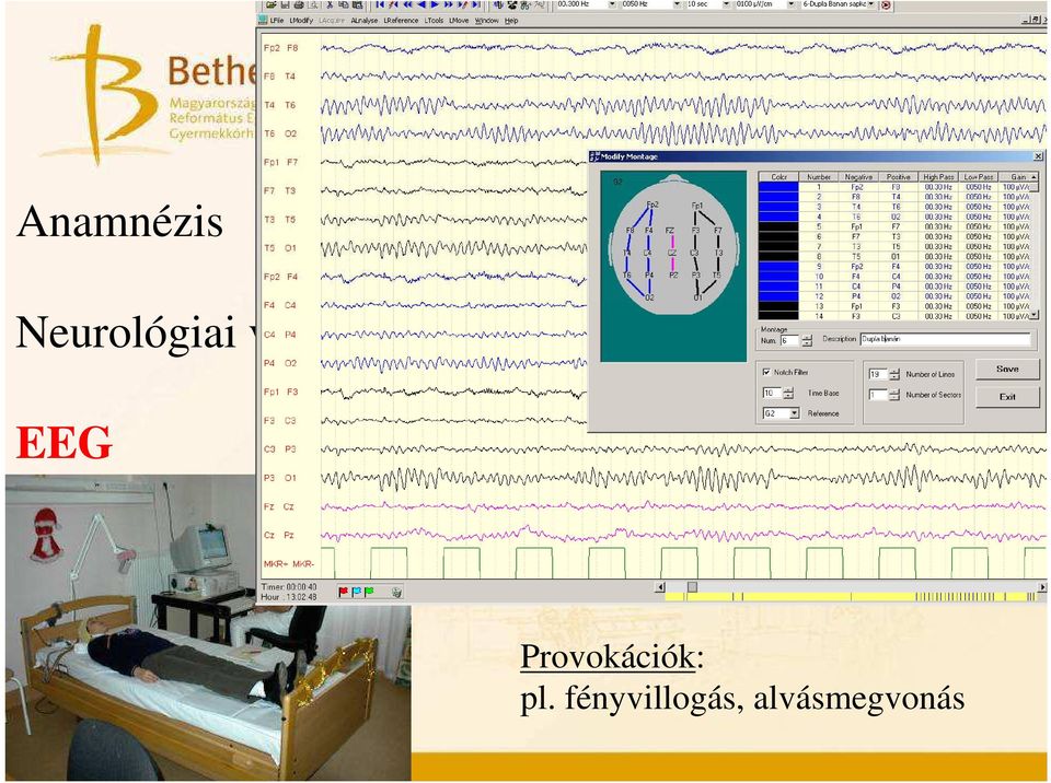 Képalkotó vizsgál Videó-EEG monit
