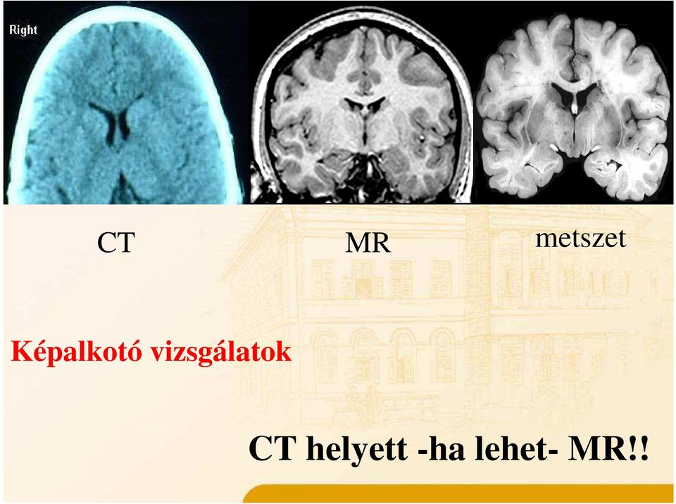 metszet Képalkotó