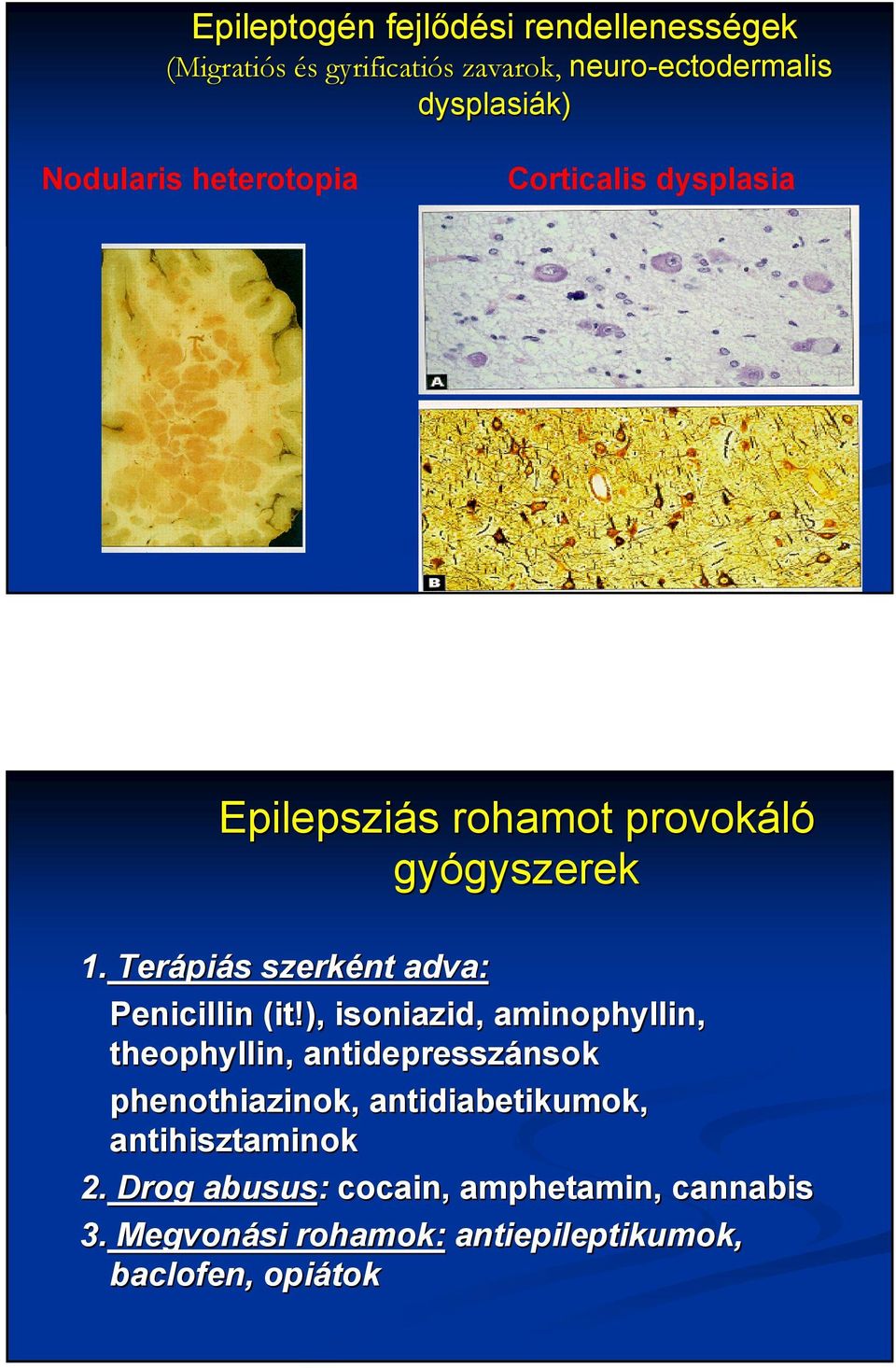 Terápi piás s szerként adva: Penicillin (it( it!