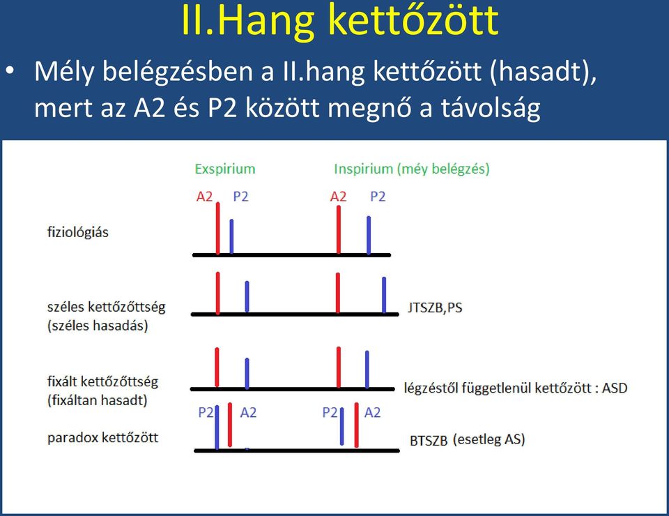 hang kettőzött (hasadt),