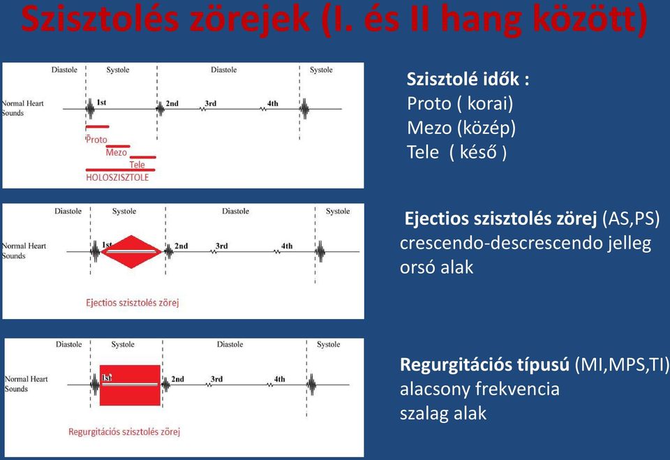 (közép) Tele ( késő ) Ejectios szisztolés zörej (AS,PS)