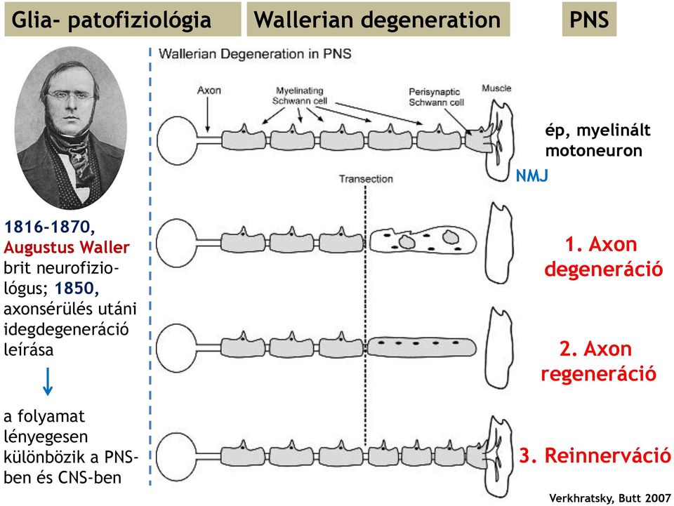 idegdegeneráció leírása a folyamat lényegesen különbözik a PNSben és