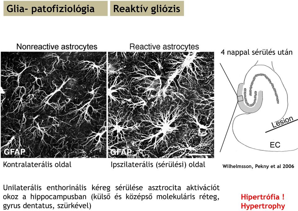 Unilaterális enthorinális kéreg sérülése asztrocita aktivációt okoz a