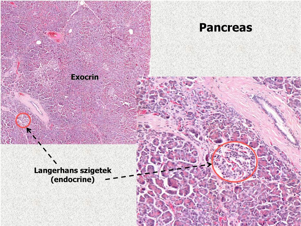 Langerhans