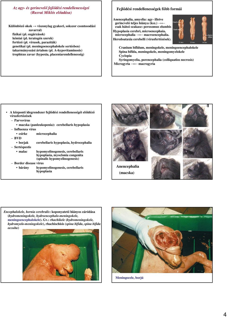 A-hypovitaminosis) trophicus zavar (hypoxia, placentarendellenesség) Fejlıdési rendellenességek fıbb formái Anencephalia, amyelia: agy- illetve gerincvelı teljes hiánya (ksz.