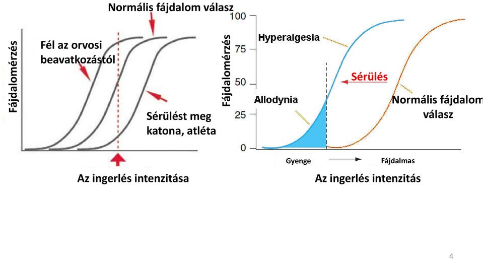 katona, atléta Sérülés Normális fájdalom válasz Az