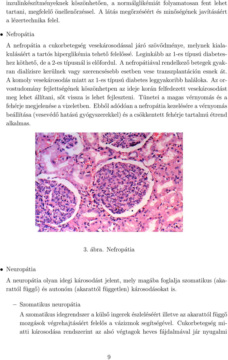 Leginkább az 1-es típusú diabeteshez köthető, de a 2-es típusnál is előfordul. A nefropátiával rendelkező betegek gyakran dialízisre kerülnek vagy szerencsésebb esetben vese transzplantáción esnek át.