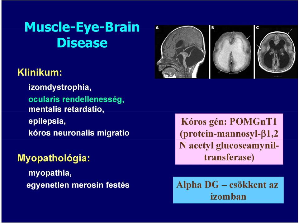 migratio Myopathológia: myopathia, egyenetlen merosin festés Kóros gén: