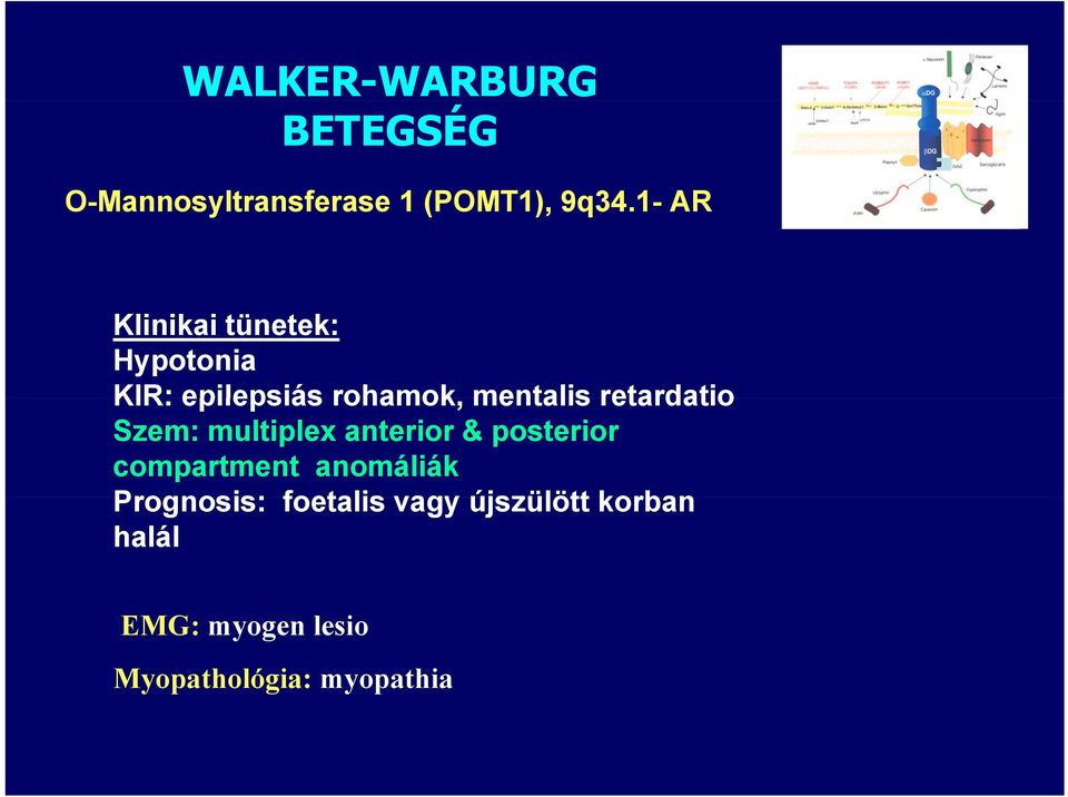 retardatio Szem: multiplex anterior & posterior compartment anomáliák