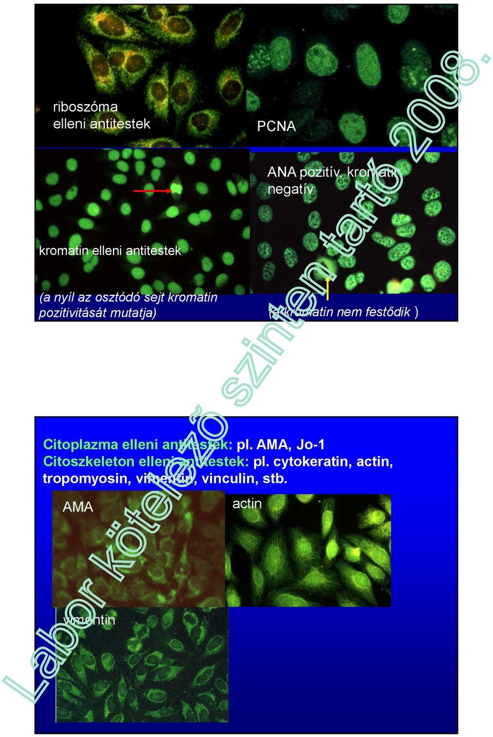 festődik ) Citoplazma elleni antitestek: pl.