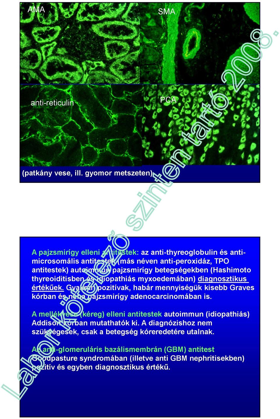 (Hashimoto thyreoiditisben és idiopathiás myxoedemában) diagnosztikus értékűek. Gyakran pozitívak, habár mennyiségük kisebb Graves kórban és néha pajzsmirígy adenocarcinomában is.