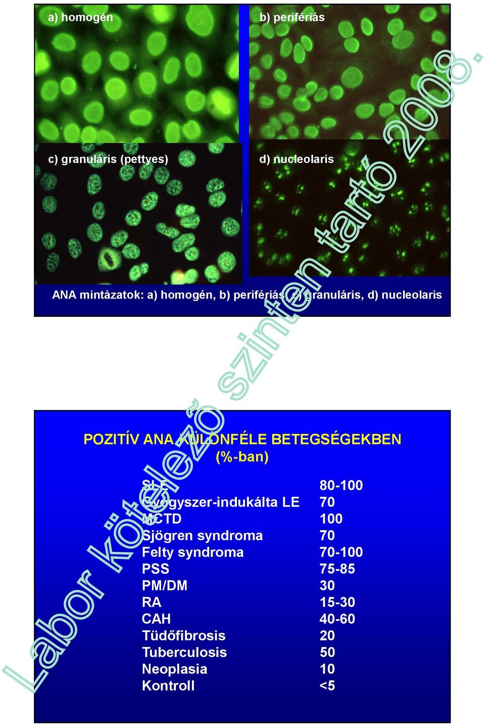 (%-ban) SLE 80-100 Gyógyszer-indukálta LE 70 MCTD 100 Sjögren syndroma 70 Felty syndroma