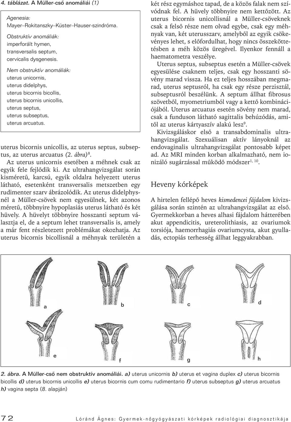 uterus bicornis unicollis, az uterus septus, subseptus, az uterus arcuatus (2. ábra) 8. Az uterus unicornis esetében a méhnek csak az egyik fele fejlôdik ki.