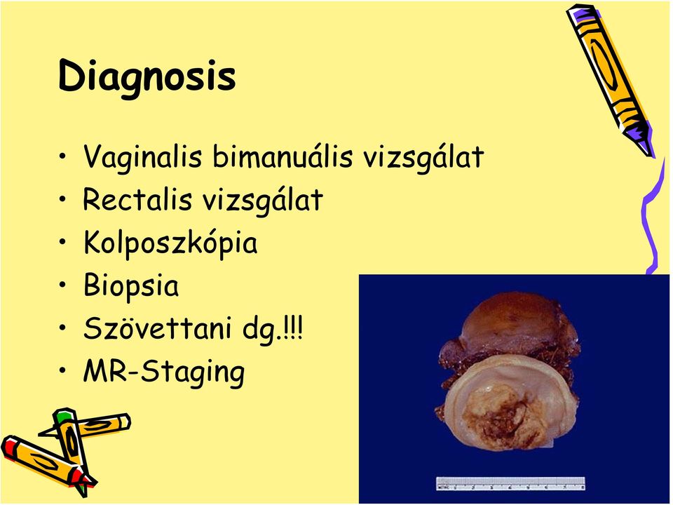 Rectalis vizsgálat