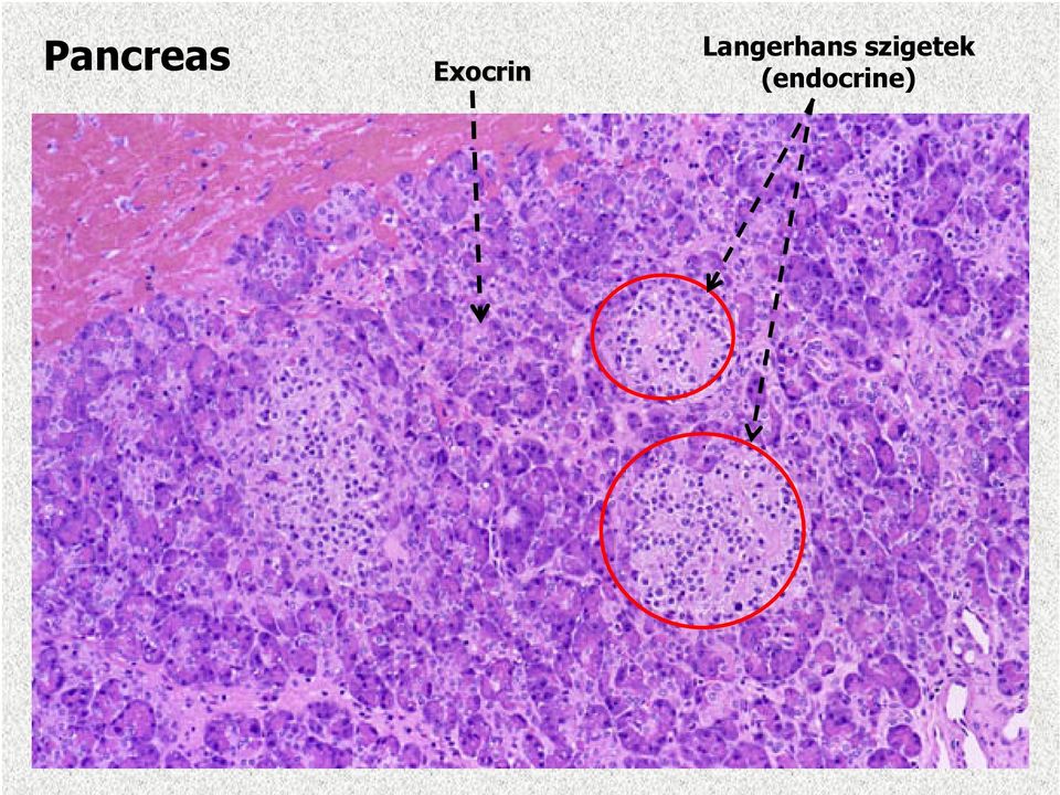 Langerhans