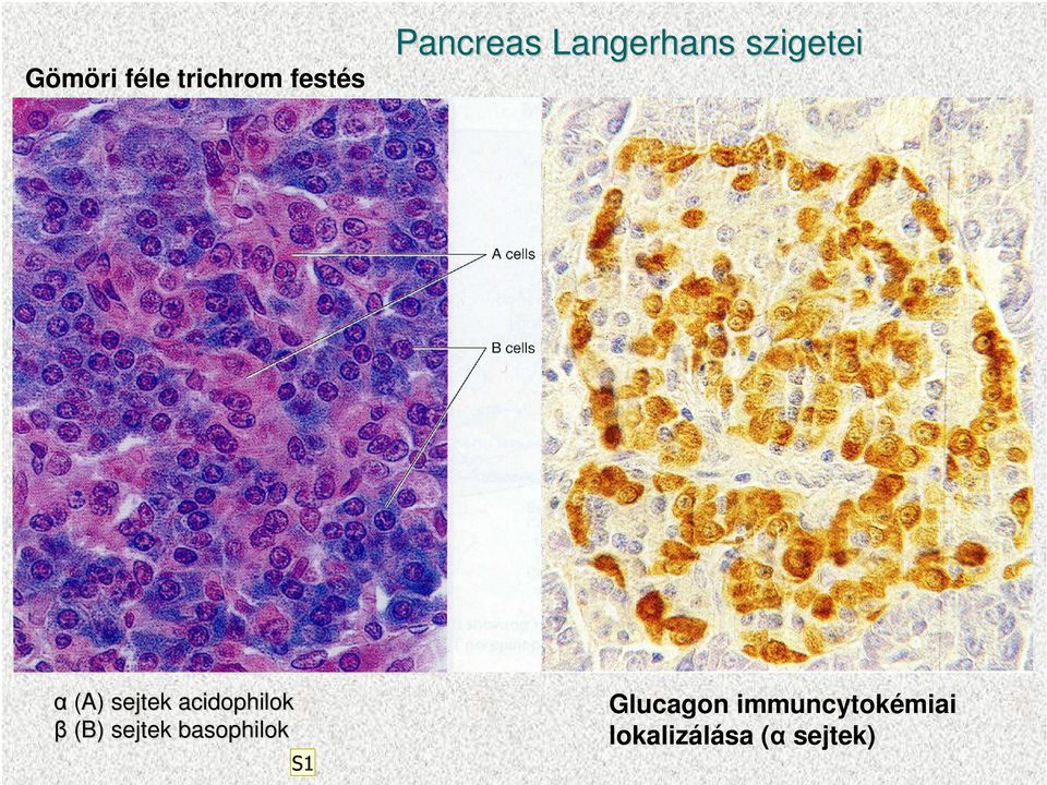 basophilok S1 Pancreas Langerhans