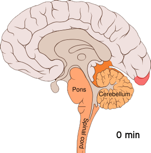 1944, Aristid Leao írta le Spreading depression a wave of electrophysiological hyperactivity followed by a wave of inhibition, usually in the visual cortex - silencing of brain electrical activity -