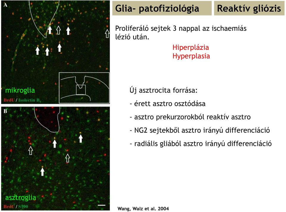 osztódása - asztro prekurzorokból reaktív asztro - NG2 sejtekből asztro irányú