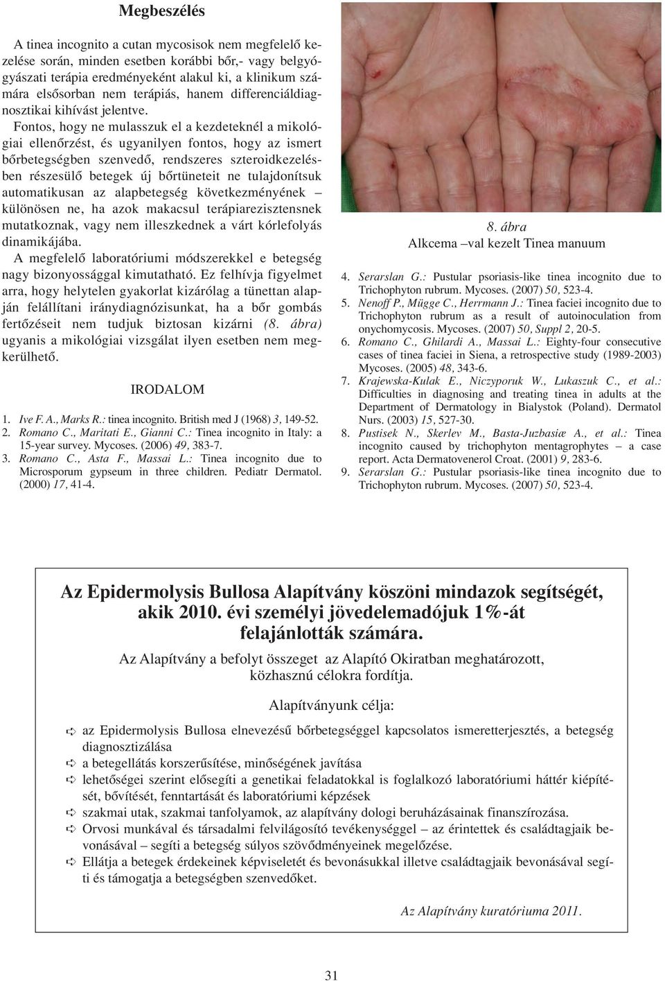 Fontos, hogy ne mulasszuk el a kezdeteknél a mikológiai ellenôrzést, és ugyanilyen fontos, hogy az ismert bôrbetegségben szenvedô, rendszeres szteroidkezelésben részesülô betegek új bôrtüneteit ne