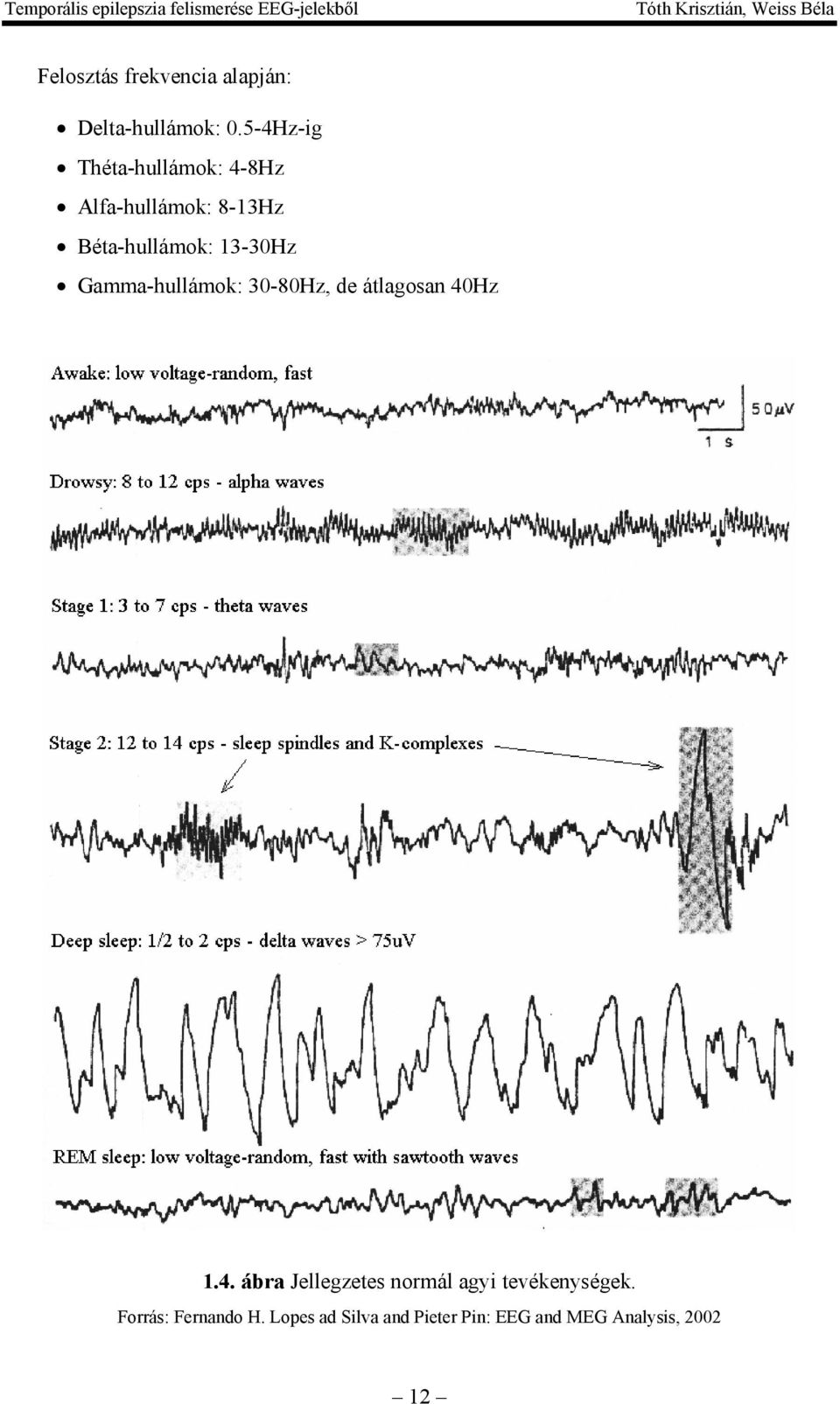 13-30Hz Gamma-hullámok: 30-80Hz, de átlagosan 40