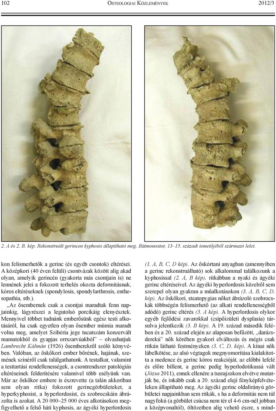 A középkori (40 éven felüli) csontvázak között alig akad olyan, amelyik gerincén (gyakorta más csontjain is) ne lennének jelei a fokozott terhelés okozta deformitásnak, kóros eltéréseknek