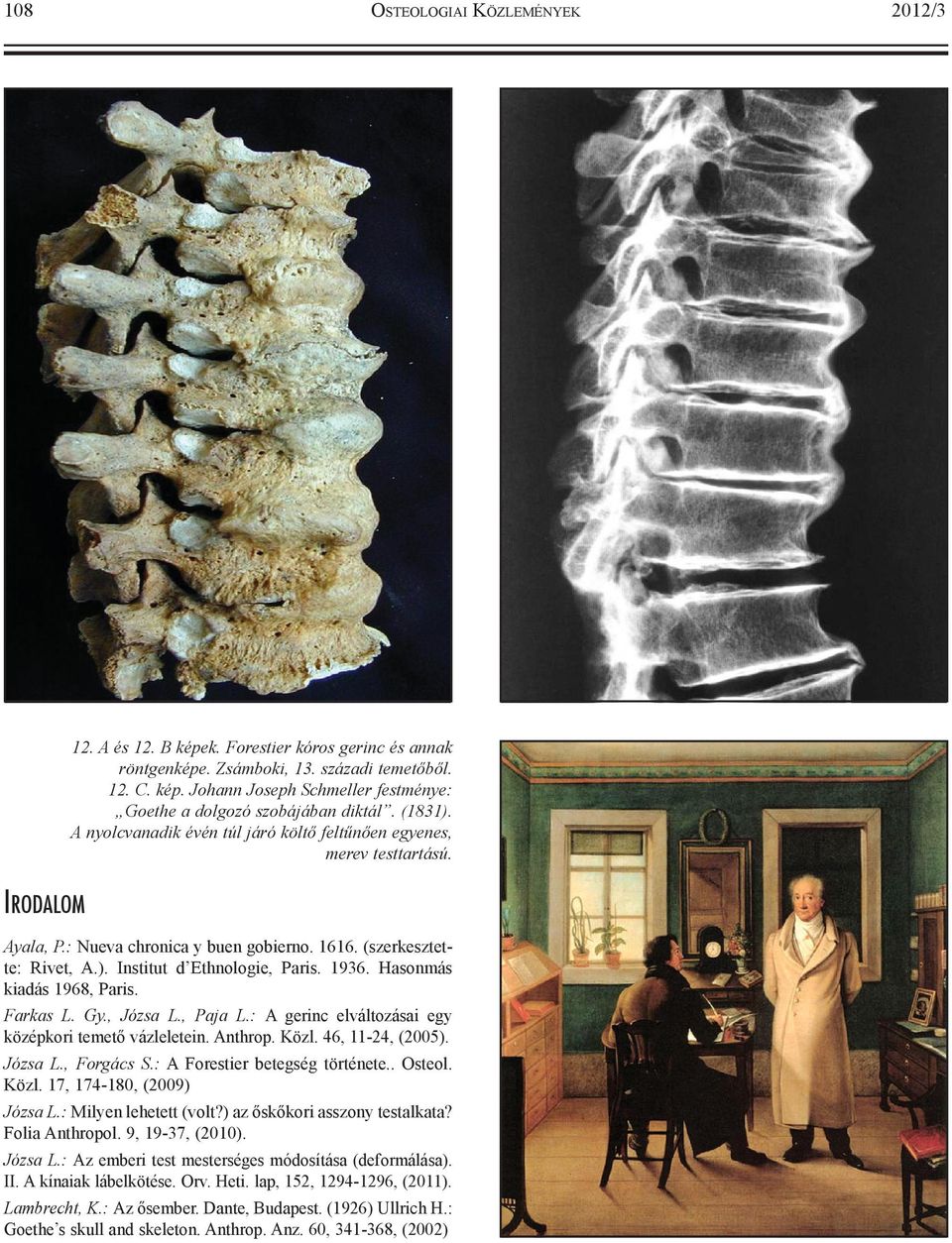 1936. Hasonmás kiadás 1968, Paris. Farkas L. Gy., Józsa L., Paja L.: A gerinc elváltozásai egy középkori temető vázleletein. Anthrop. Közl. 46, 11-24, (2005). Józsa L., Forgács S.