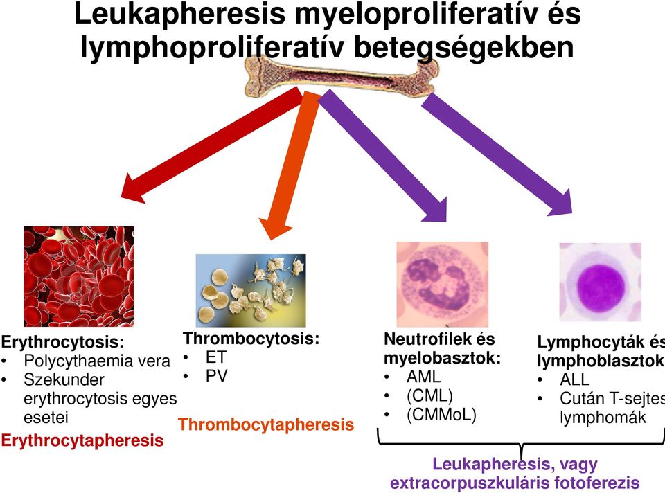 Erythrocytapheresis Thrombocytapheresis Neutrofilek és myelobasztok: AML (CML) (CMMoL)